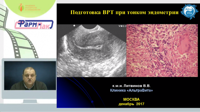 Литвинов В.В. - Подготовка к ВРТ при тонком эндометрии. Часть 1. Хронический эндометрит как причина тонкого эндометрия.
