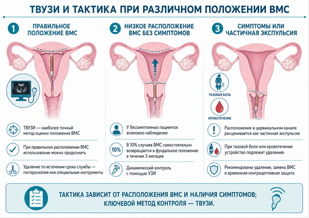Рис2