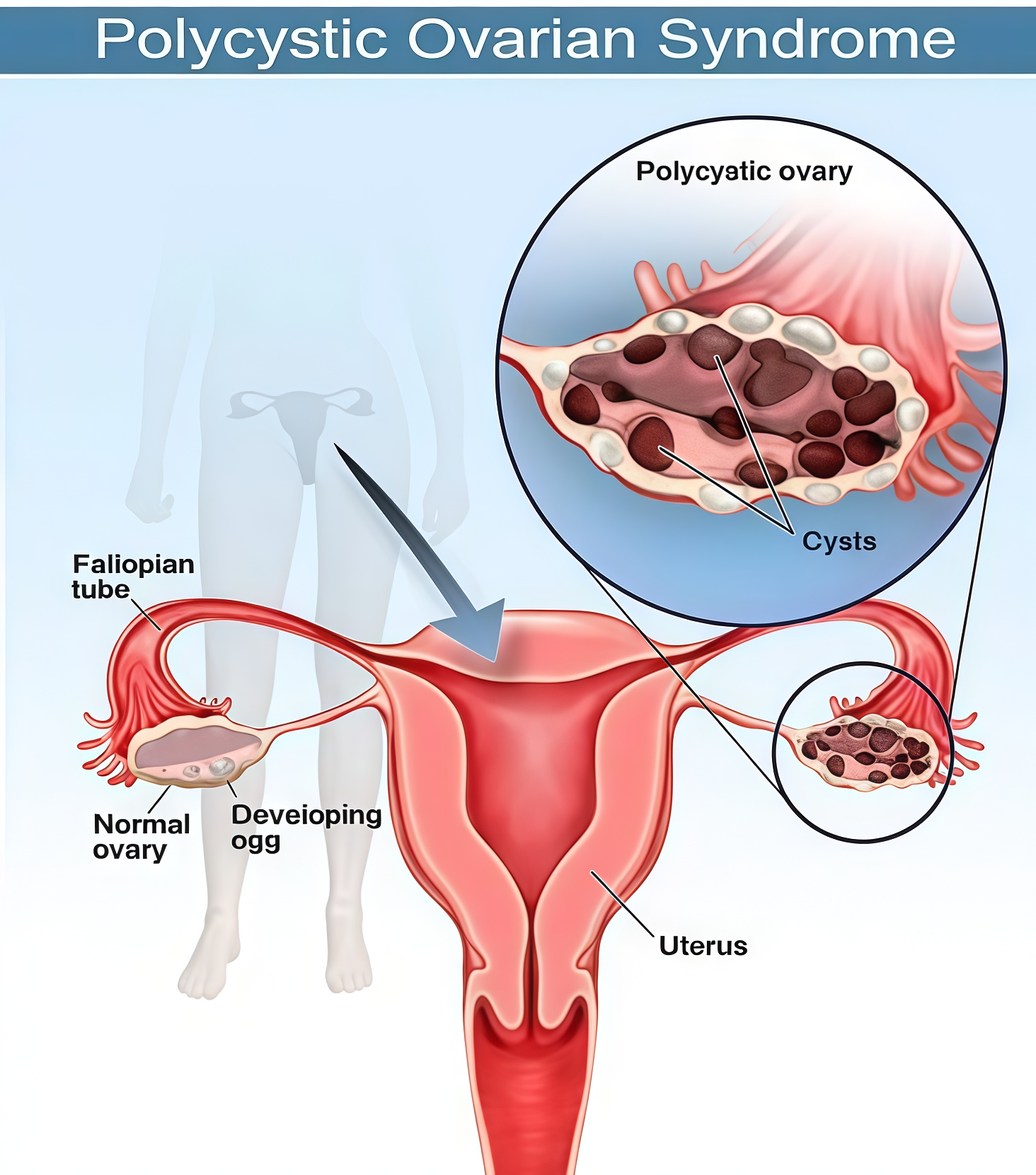 Диагностика СПЯ по состоянию на 2025 год