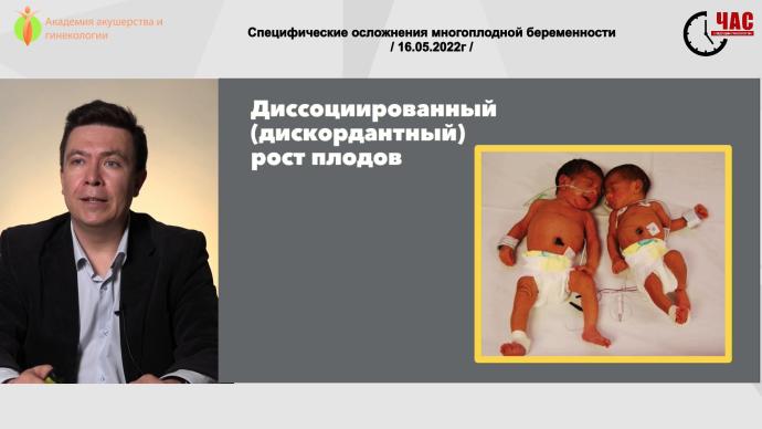 Кузнецов П.А. - Специфические осложнения многоплодной беременности