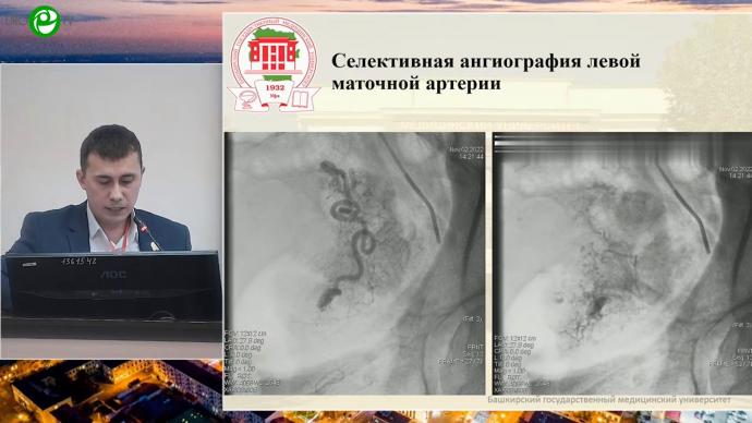 Ибрагимов Т.Р. - Рентгенэндоваскулярная помощь при злокачественных новообразованиях органов малого таза