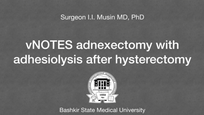 Surgeon I.I. Musin MD, PhD - vNOTES adnexectomy with adhesiolysis after hysterectomy