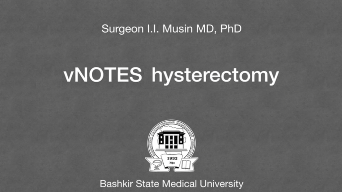 Surgeon I.I. Musin MD, PhD - vNOTES Hysterectomy