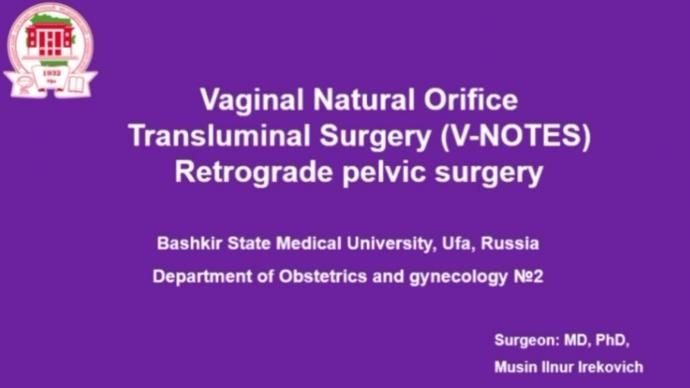 Vaginal Natural Orifice Transluminal Surgery (V-NOTES) Retrograde pelvic surgery