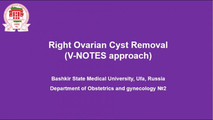 Right Ovarian Cyst Removal (V-NOTES approach). Удаление кисты правого яичника