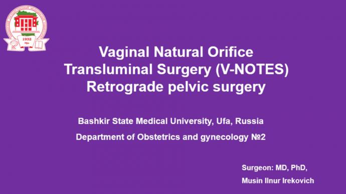 Retorgrade pelvic surgery (adhesions in abdominal cavity). Ретроградная хирургия органов малого таза 