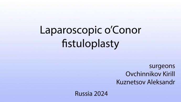 Laparoscopic o'Conor fistuloplasty. Лечение пузырно-влагалищного свища по методике o'Conor.