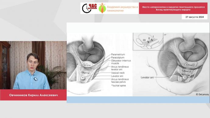 Овчинников К.А. - Место лапароскопии в хирургии генитального пролапса. Взгляд практикующего хирурга