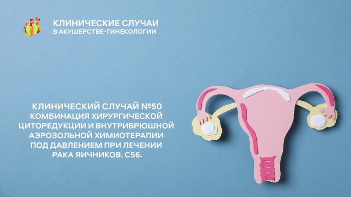 Клинический случай №50 Комбинация хирургической циторедукции и внутрибрюшной аэрозольной химиотерапии под давлением при лечении рака яичников. С56.