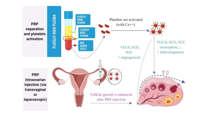 Без рекламы! Лечение СПКЯ 2025 г: от классики к персонализированным и инновационным подходам