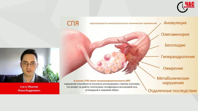 Иванов И.А. - Новое в лечении и диагностике СПЯ