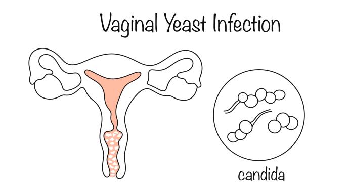 Патогенность Candida и кислотность среды: новые данные