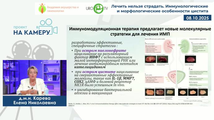 Тевлин К.П., Карева Е.Н. - Лечить нельзя страдать. Иммунологические и морфологические особенности цистита