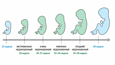 В Чувашии выписан ребёнок, родившийся на 26-й неделе с массой 745 г
