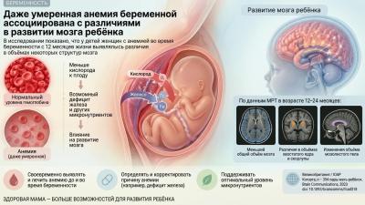 Даже умеренная анемия беременной ассоциирована с различиями в развитии мозга ребёнка