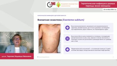Чернова Н.И. - Герпетическая инфекция в разные периоды жизни женщины