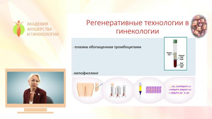 Елисеева М.Ю. - Регенеративные технологии в гинекологии